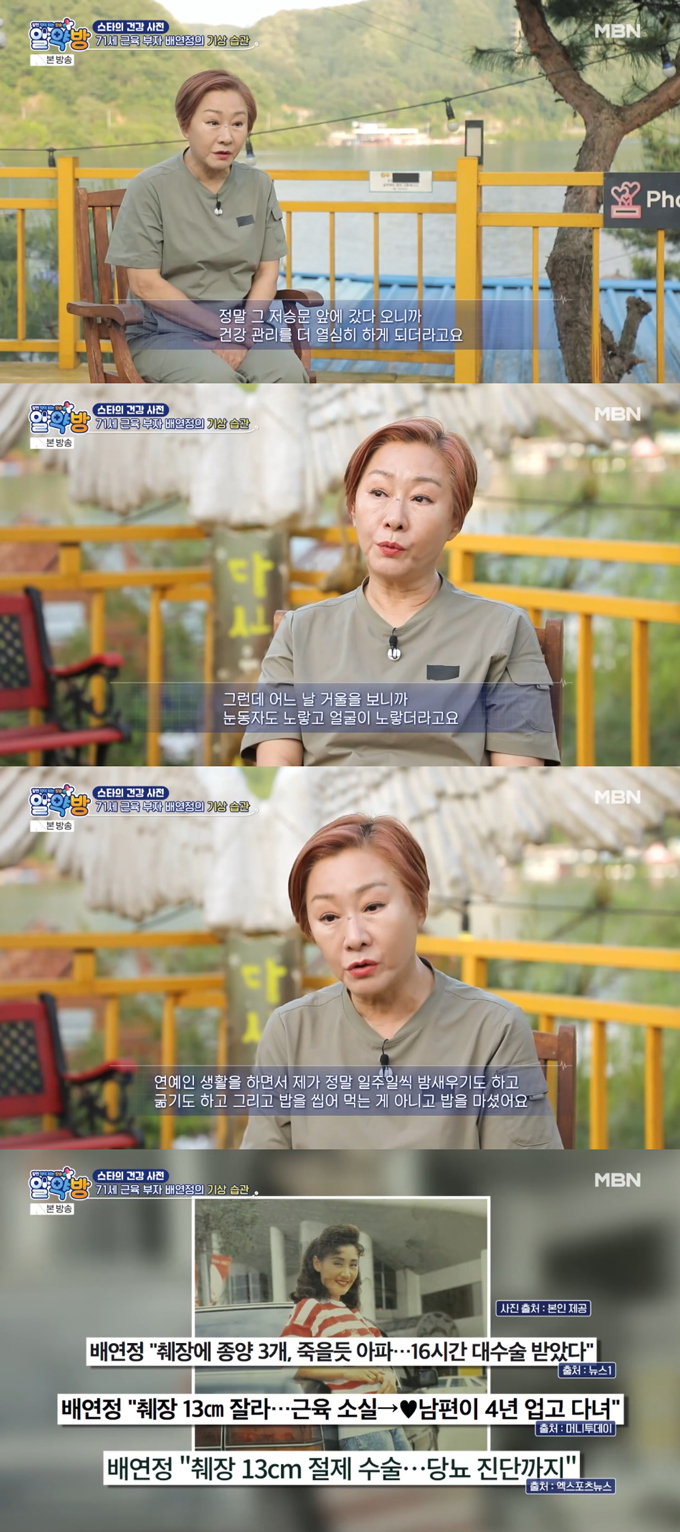 /사진=MBN &#039;알약방&#039; 방송 화면