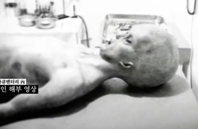 1995년 공개된 외계인 사체 해부 영상./사진=유튜브 'tVN 벌거벗은 세계사'