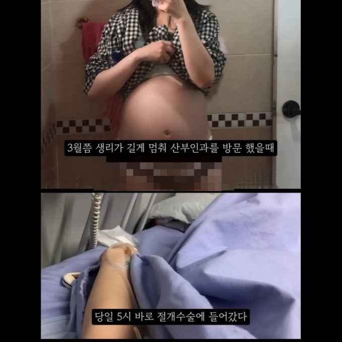 지난달 20대 여성이라고 주장하는 A씨가 자신의 유튜브 채널에 공유했던 임신 36주 차 낙태 브이로그 영상의 한 장면. 이 영상은 큰 논란이 됐고, A씨는 영상을 삭제했다. /사진=온라인 커뮤니티 캡처 