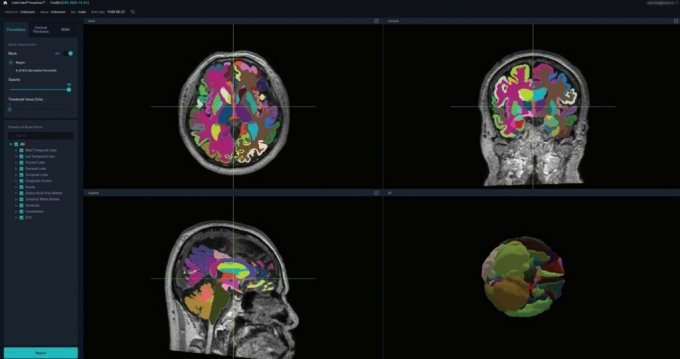 뷰노메드 딥브레인 운영화면. /사진제공=뷰노메드