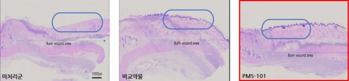 강스템바이오텍의 계열사 프리모리스테라퓨틱스의 엑소좀 기반 화상치료제 'PMS-101'이 호주 식품의약품안전청(TGA)으로부터 1·2a상 임상시험계획(CTN)을 승인받았다고 1일 밝혔다. /사진제공=강스템바이오텍