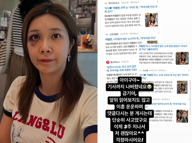 아나운서 출신 방송인 이정민이 멍이 든 눈에 대해 해명했다. /사진=이정민 인스타그램