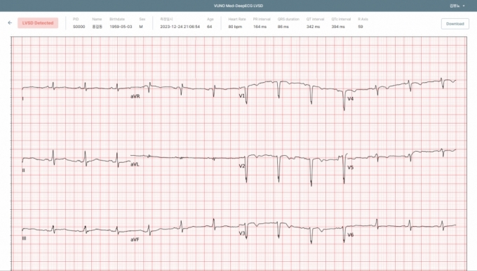 ޵-ECG LVSD ȭ. /=