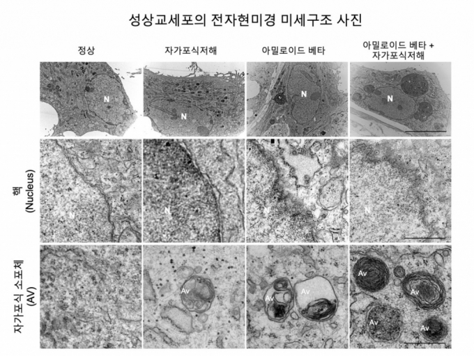 별세포내에서 자가포식 작용이 억제되면서 독성 단백질인 아밀로이드 베타 (Aβ)를 제거하던 작용도 함께 억제되는 모습. /사진=KIST