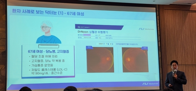 이날 가지간담회에서 세브란스병원 내분비내과 이용호 교수가 당뇨병·고지혈증이 있는 67세 여성 환자의 망막 촬영 결과를 설명하고 있다. /사진=정심교 기자