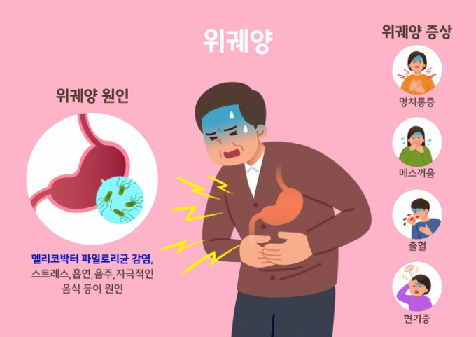 헬리코박터균 방치해 위궤양 생긴 사람, 치매 발생 위험 3배 높았다