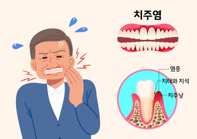 잇몸 무너지면 일상도 '와르르'…치매·골다공증 부른다