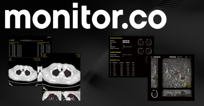 폐암·유방암 찾는 AI 기술…모니터코퍼레이션, 70억 투자유치