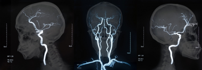  MRI Կ .