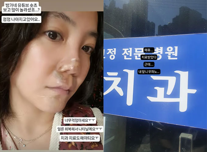 배우 고은아(왼쪽)이 8일 자신의 인스타그램을 통해 치과를 찾은 모습을 공개했다. /사진=고은아 인스타그램