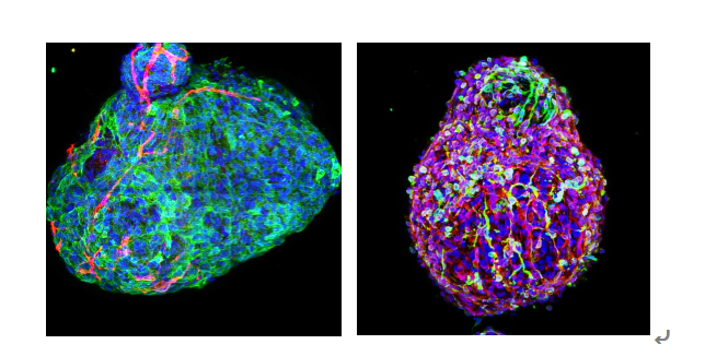 심장 오가노이드 분석 3D 이미징,(왼쪽)혈관세포 (VE-cad+, 빨간색) 및 심근세포 (cTNT+, 초록색) 로 구성된 3D 심장 오가노이드의 모습, 심근 섬유아세포 (Vimentin+, 초록색) 및 심장 근육세포 (α-actin+, 빨간색) 로 구성된 3D 심장 오가노이드의 모습 /사진제공=넥셀