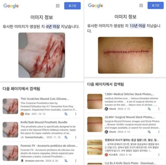  7일 배우 고(故) 김새론 유족 측 법률대리인과 유튜브 채널 &#039;가로세로연구소&#039; 김세의 대표는 김수현과 관련한 녹취 파일을 가진 제보자가 최근 피습당했다며 사진을 공개했다. 이에 대해 김수현 측은 &quot;인터넷에서 내려 받은 사진을 &#039;피습 사진&#039;이라고 주장하고 있다&quot;고 반박했다. /사진=골드메달리스트