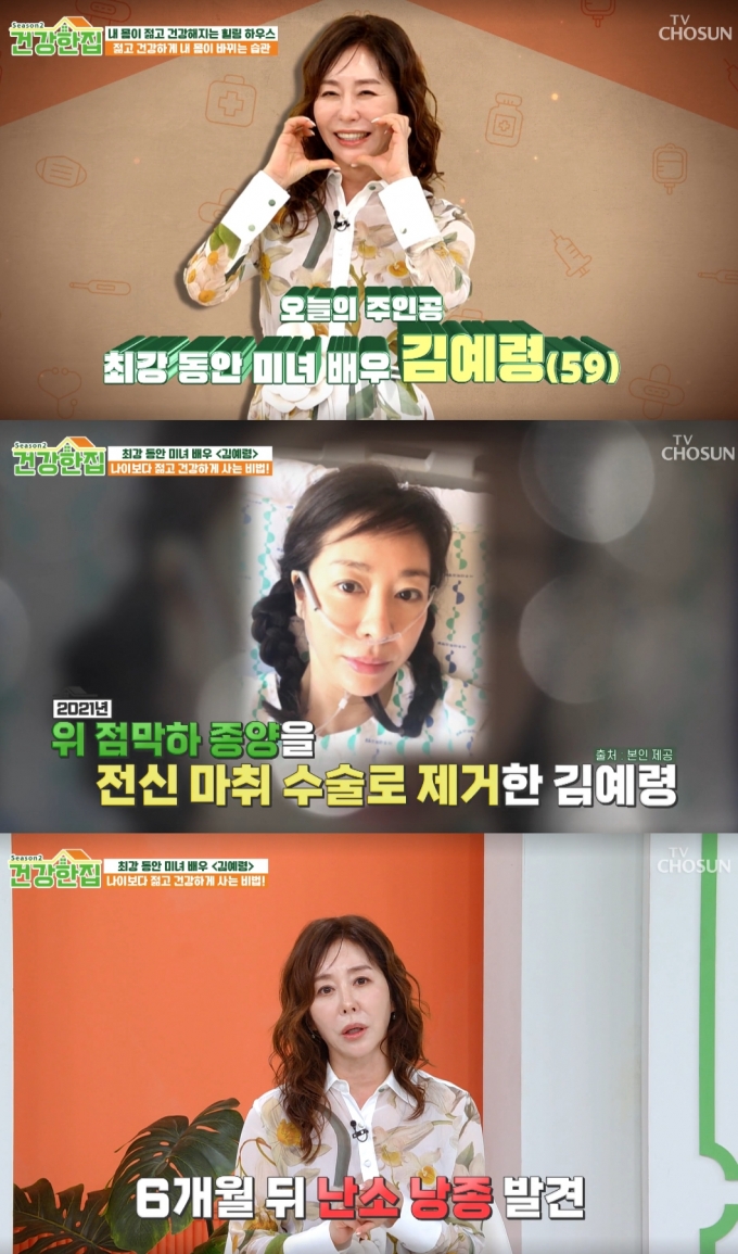 배우 김예령이 세 차례나 전신 마취 수술을 진행했다고 밝혔다. /사진=TV조선 &#039;건강한집&#039; 시즌2 방송화면