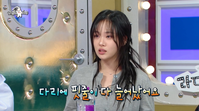 가수 겸 배우 비비가 강추위 속 연기 투혼을 불태운 뒤 수술까지 받게 된 사연을 전했다./사진=MBC &#039;라디오스타&#039; 방송 화면