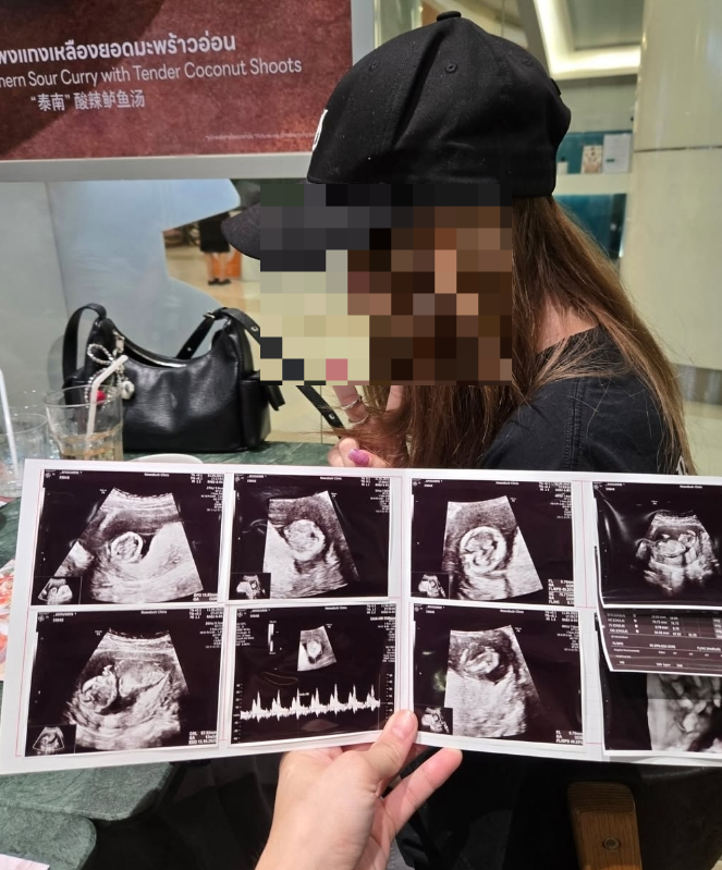티케이의 전 여자친구와 초음파 사진 /사진=티케이 인스타그램