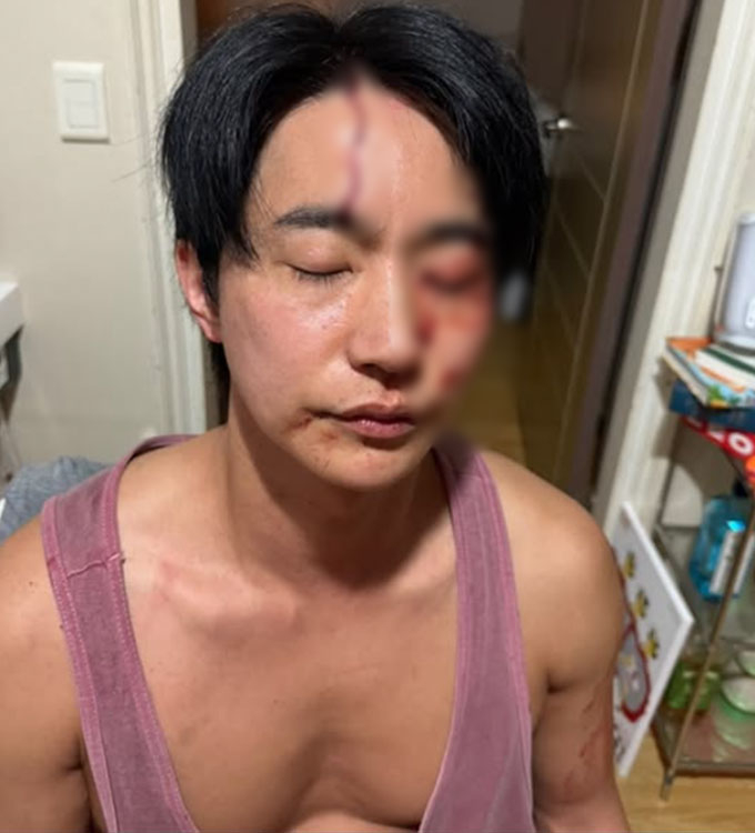 전호준은 지난 25일 자신의 인스타그램을 통해 머리에 피 흘리는 사진과 지난 24일 새벽 당시 상황을 담은 음성을 공개하며 &quot;왜곡된 주장과 허위 사실&quot;이라고 전 여자친구 A씨 폭로에 대해 반박했다./사진=전호준 인스타그램 
