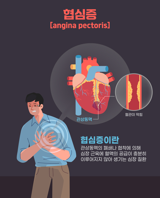 출근 전 새벽 조깅하던 김부장…"숨 차고 가슴통증" 이 신호일 수도 - 머니투데이