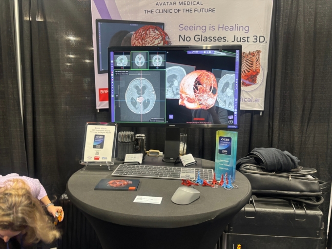 프랑스 스타트업 아바타 메티컬 부스/사진=남미래 기자