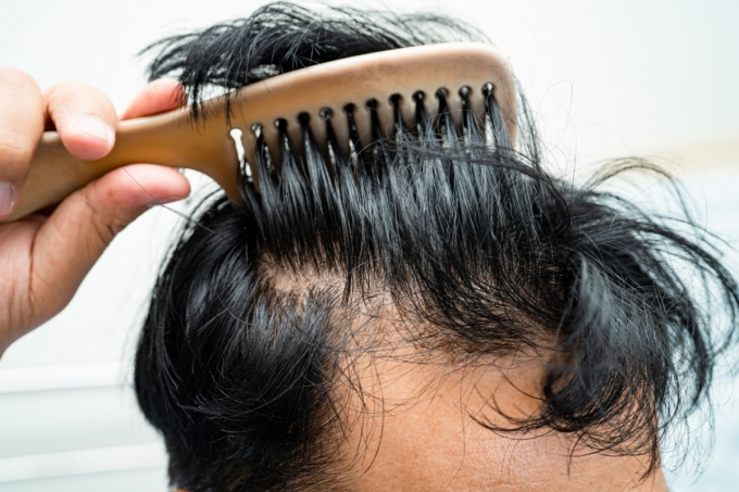 /사진=게티이미지뱅크