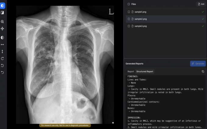 /사진=숨빗AI 제공