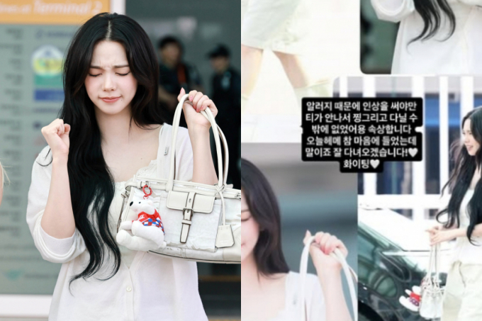 공항서 인상 찌푸린 카리나…알고 보니 '알레르기' 때문 "저도 속상"