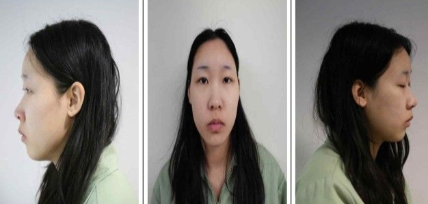 '모텔 살인' 김소영 측 "추가 피해자 3명 만났지만, 약물 건넨 적 없어"