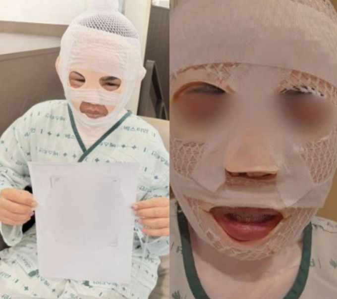"상상 초월한 반인륜 범죄"…'아내 얼굴에 끓는 물' 남편, 징역 3년6개월