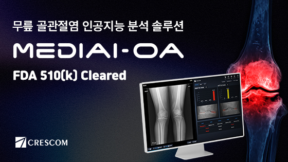 크레스콤, 무릎 골관절염 솔루션 美 FDA '510(k) 의료기기' 허가