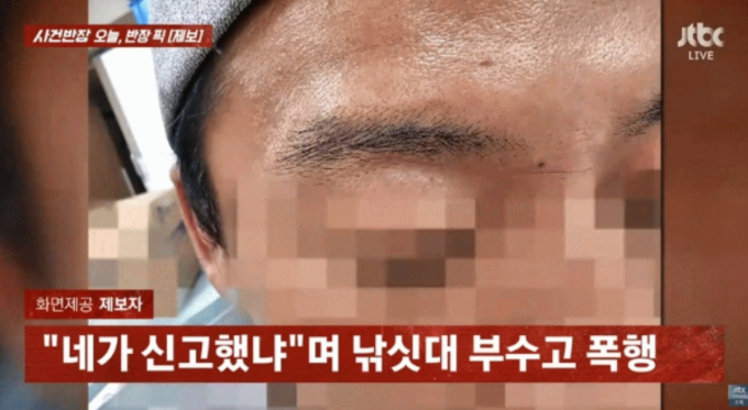 여성 폭행 막으려 신고했다가…"네가 경찰 불렀냐" 보복폭행 피해