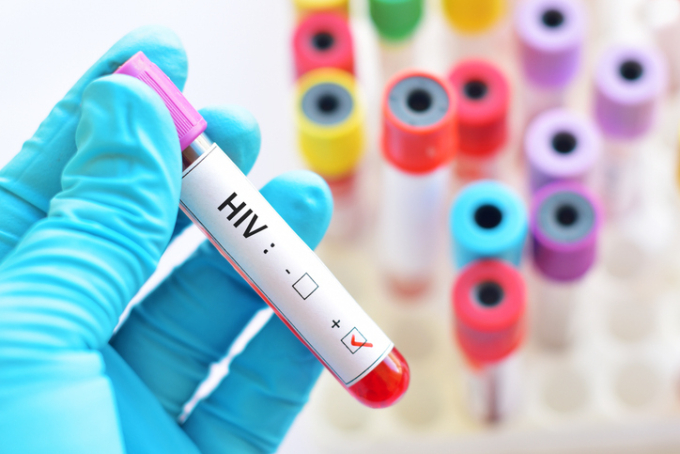 한국인 HIV 신규 감염 600명대 '20년만 최저'…감염자 66%가 2030