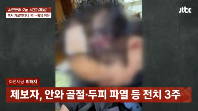 "깜빡이 기분 나빠서"…택시 세우고 무차별 폭행, 기사는 전치 3주