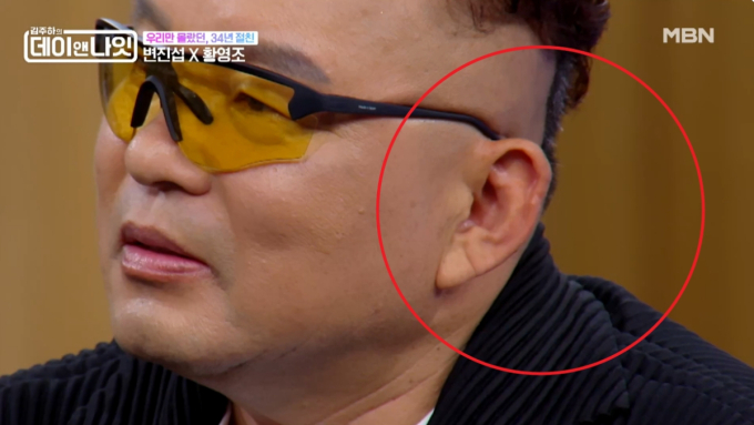 변진섭 "내 골프공에 황영조 뇌진탕, 의식 잃어…50바늘 꿰매"