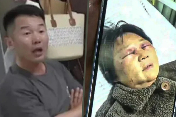손주 안 보고 애인 만나러 갔다고…시모 갈비뼈 부러뜨린 中 며느리