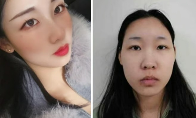 '약물 살인 혐의' 재판도 안 끝났는데…김소영 "취직해 손해배상금 빨리 갚고파"