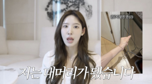 이나연, 모발이식 부작용으로 탈모…"1cm 채우려다 30cm 날아가"