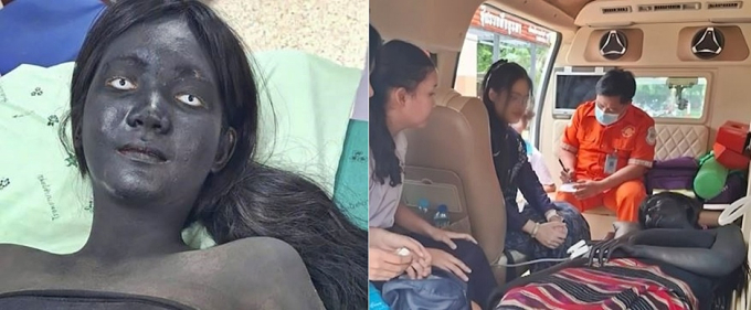 응급실에 온몸 까만 귀신 환자가?…태국 구조대 놀라게 한 여학생