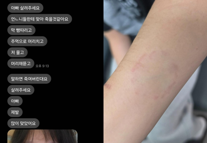 "아빠 살려줘요" 집단폭행 당한 딸의 문자…바지까지 벗긴 선배들