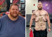 2년간 150kg 감량한 美 남성…충격적인 '상탈' 사진 공개