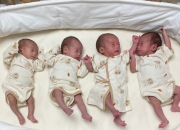 출근 이틀만에 '네쌍둥이' 임신 소식…의료비·육아도우미 지원한 회사