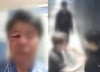 "밖엔 여학생 2명 대기"…신분증 요구하자 모텔 사장 폭행한 20대