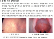 "베트남 갔다가 42명 감염"…3주 내 발열·발진 증상 나타났다