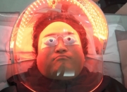 선크림 떡칠했는데도 "더 심해졌다"…구성환 앓는 이 질환, 뭐길래