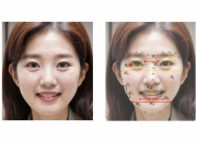 얼굴은 어디부터 늙을까…LG생활건강, AI로 노화 공식 밝혀냈다
