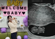 '13남매 장녀' 남보라, 엄마 됐다…"내년 6월 출산, 태몽은 가오리"