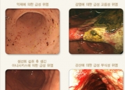 "그냥 숙취인 줄 알았는데"...당장 병원 가야 할 복통 신호