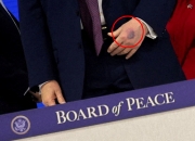 손등에 커다란 '멍 자국'...트럼프, 건강이상설 또 터졌다