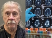 "치매 아내 돌볼 바엔 감옥 갈래" 맨정신에 총 쏜 80대 전직 경찰