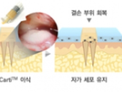 <strong>엘앤씨바이오</strong>, '메가카티' 무릎연골 재생 효과 통계적 유의성 확인
