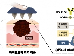 <strong>아이큐어</strong> 자회사 커서스바이오, 흑색종 패치 성과 공개