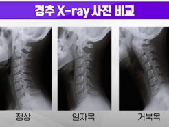 [߳ ǰϱ] (21) Ÿ ڼ ô߸ 츰<1>